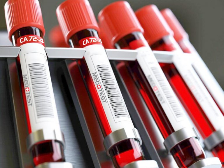 (CA 724) Skrandžio vėžio žymuo Medtest laboratorija