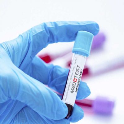 Giminystės / zigotiškumo DNR testas (Tiriami 2 asmenys)
