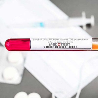Prenatalinis neinvazinis tėvystės nustatymo DNR tyrimas (Tiriamas motinos ir galimo tėvo kraujas)