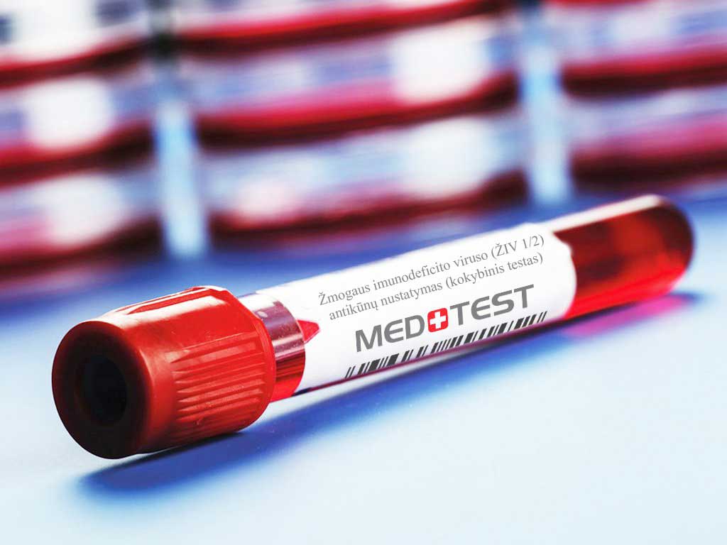 Žmogaus imunodeficito viruso (ŽIV 1/2) antikūnų nustatymas (kokybinis testas)